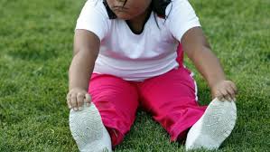 Obesity Childhood Obesity Childhood