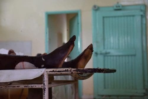 The body of one of the campus attack terrorists is seen at a mortuary in Garissa county hospital, Garissa, Kenya, April 4, 2015. Kenya's Interior Minister Joseph Nkaissery said on Friday the death toll of the attack at the Garissa University College includes 142 students, three policemen and three soldiers from Kenya Defense Forces. The four terrorists from 'al-Shabaab' were all killed during the rescue operation, the official confirmed. (Xinhua/Sun Ruibo)(dh) The body of one of the campus attack terrorists is seen at a mortuary in Garissa county hospital, Garissa, Kenya, April 4, 2015. Kenya's Interior Minister Joseph Nkaissery said on Friday the death toll of the attack at the Garissa University College includes 142 students, three policemen and three soldiers from Kenya Defense Forces. The four terrorists from 'al-Shabaab' were all killed during the rescue operation, the official confirmed. (Xinhua/Sun Ruibo)(dh)