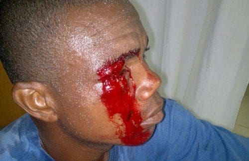 Justice Adzakumah, demo victim Justice Adzakumah, demo victim