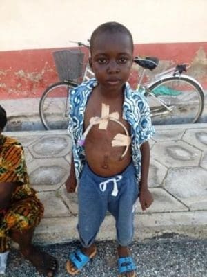 Boy Operation Boy Operation