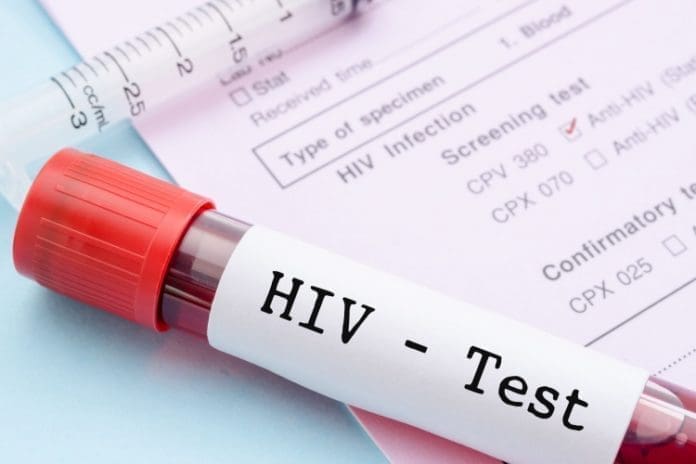 HIV infections HIV test