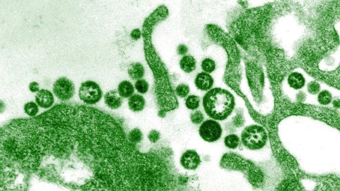 Lassa Fever